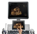 Ультразвуковой сканер Mindray DC-70 — изображение 3