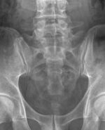 Рентген аппарат Mindray DigiEye 560 цифровой — изображение 18