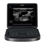 Ультразвуковой сканер SonoSite Edge портативный