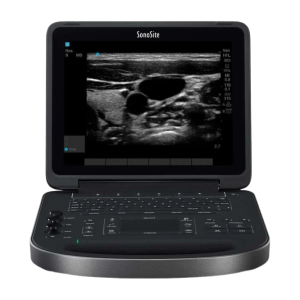 Ультразвуковой сканер SonoSite Edge портативный