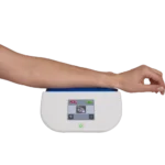 Анализатор конечных продуктов гликирования AGE Reader — изображение 2