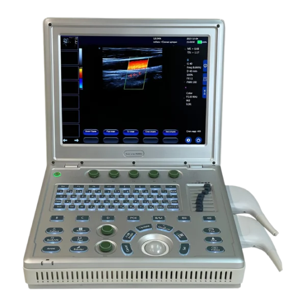 Acuvista RS880c Портативный аппарат УЗИ