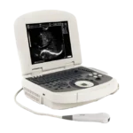 Acuvista VT98c Портативный аппарат УЗИ