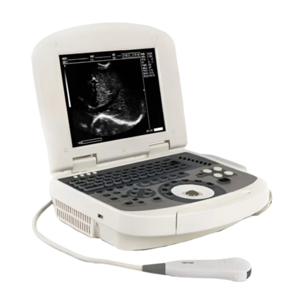 Acuvista VT98c Портативный аппарат УЗИ