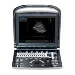 Chison SonoTouch 10 Портативный аппарат УЗИ