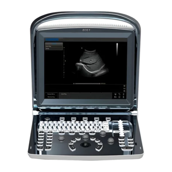 Chison SonoTouch 10 Портативный аппарат УЗИ