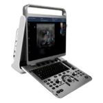 Chison SonoTouch 60 Портативный аппарат УЗИ