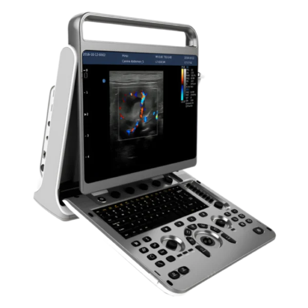 Chison SonoTouch 60 Портативный аппарат УЗИ