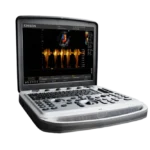 Chison SonoTouch 80 Портативный аппарат УЗИ