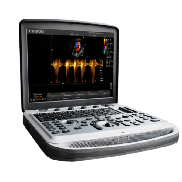 Chison SonoTouch 80 Портативный аппарат УЗИ
