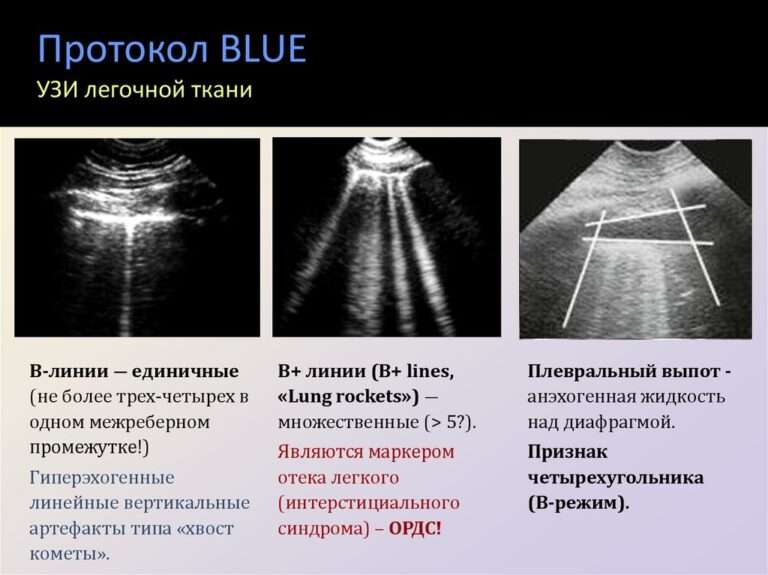 протокол УЗИ Blue