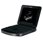 Sonosite Edge II Портативный аппарат УЗИ