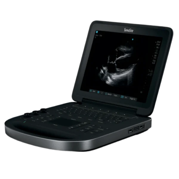 Sonosite Edge II Портативный аппарат УЗИ