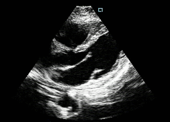 SonoiQ Q7 узи