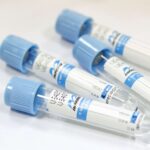 Вакуумные пробирки с цитратом натрия 3,2% IMPROVACUTER