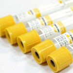 Вакуумные пробирки с активатором свертывания и гелем IMPROVACUTER