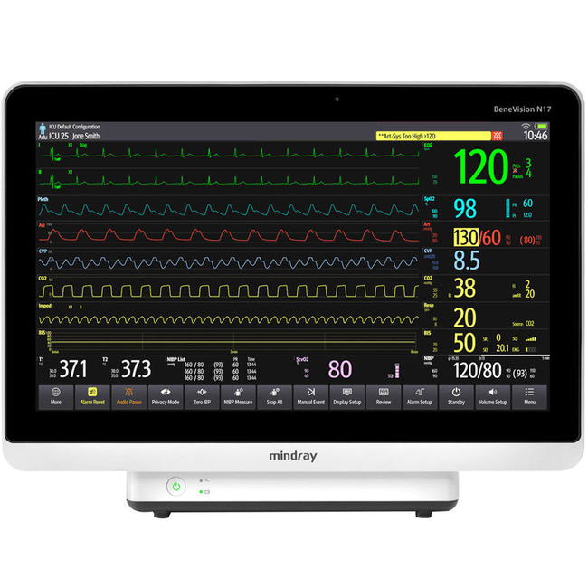 BeneVision N17