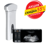 DELTA D8 ПОРТАТИВНЫЙ УЗИ АКЦИЯ