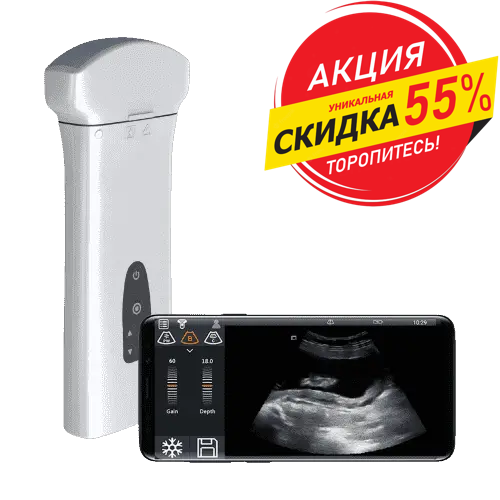 DELTA D8 ПОРТАТИВНЫЙ УЗИ АКЦИЯ