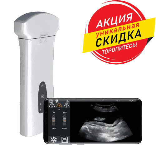Delta skidka