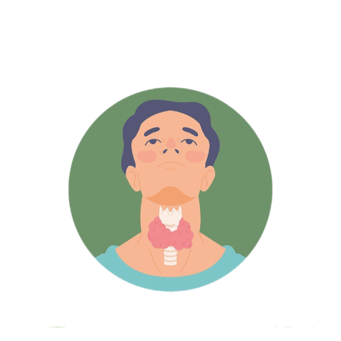 Тиреоидит аутоиммунный.