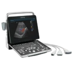 Mindray Z60 портативный