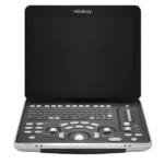 Mindray Z60 портативный_