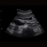 Chison SonoTouch 50 (SonoAir)
