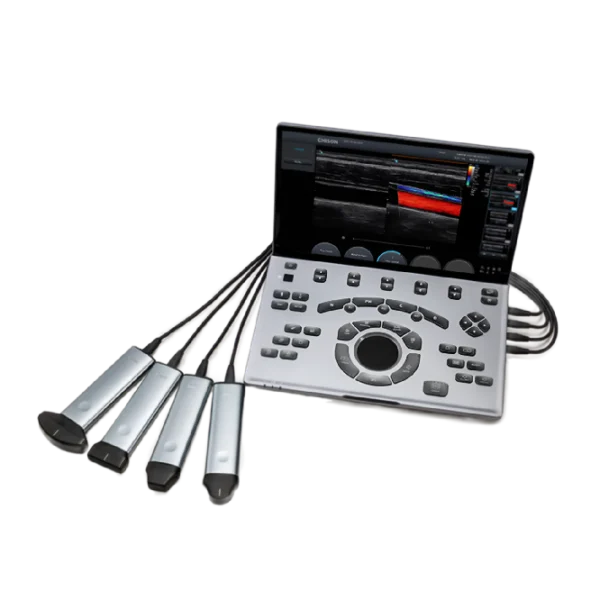 Chison SonoTouch 50 (SonoAir)
