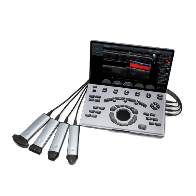 Chison SonoTouch 50 (SonoAir) Портативный УЗИ аппарат Chison SonoTouch 50 (SonoAir)
