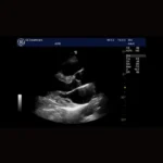 GE Healthcare Logiq E