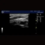 GE Healthcare Logiq E