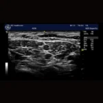 GE Healthcare Logiq E