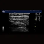 GE Healthcare Logiq E