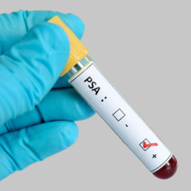 Тест ПСА