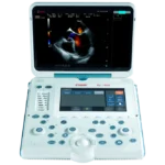Esaote MyLab Alpha
