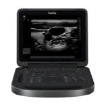 Fujifilm Sonosite Edge II