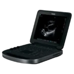 Fujifilm Sonosite Edge II