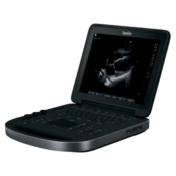 Fujifilm Sonosite Edge II