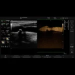 GE Healthcare Versana Active