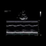 GE Healthcare Vivid IQ