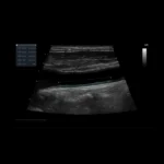 GE Healthcare Vivid IQ
