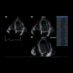 GE Healthcare Vivid IQ