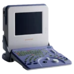 Hitachi Prosound 2