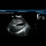 Mindray DP-30 Vet