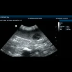 Mindray DP-30 Vet