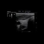 Mindray M6 Exp