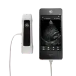 УЗИ сканер Vscan Extend