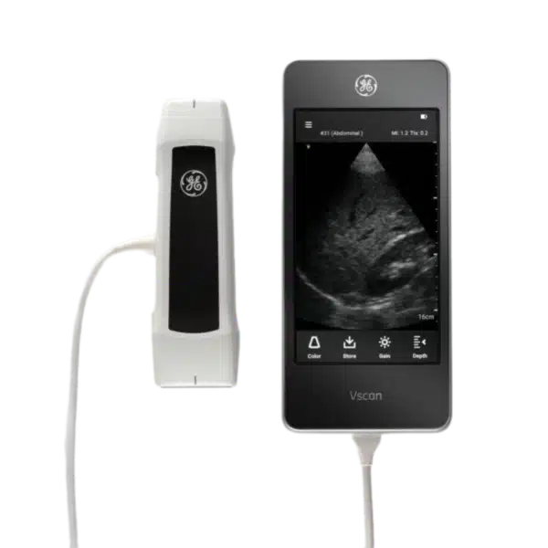 УЗИ сканер Vscan Extend