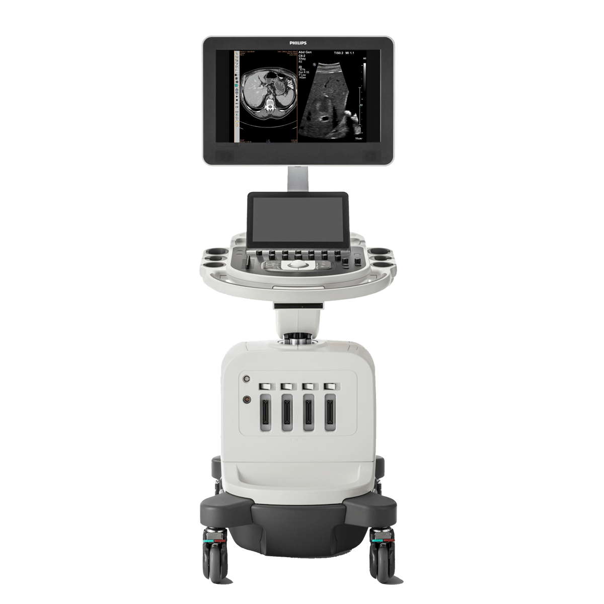 Ультразвуковая система Philips Affiniti 50
